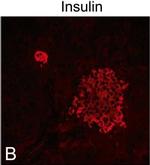 Guinea Pig IgG (H+L) Highly Cross-Adsorbed Secondary Antibody in Immunocytochemistry (ICC/IF)