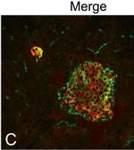 Chicken IgY (H+L) Secondary Antibody in Immunocytochemistry (ICC/IF)