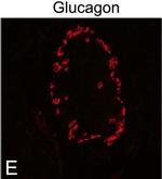 Rabbit IgG (H+L) Highly Cross-Adsorbed Secondary Antibody in Immunocytochemistry (ICC/IF)