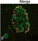 Rabbit IgG (H+L) Highly Cross-Adsorbed Secondary Antibody in Immunocytochemistry (ICC/IF)