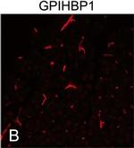 Rabbit IgG (H+L) Highly Cross-Adsorbed Secondary Antibody in Immunocytochemistry (ICC/IF)