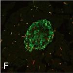 Chicken IgY (H+L) Secondary Antibody in Immunocytochemistry (ICC/IF)