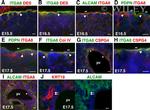 CD166 (ALCAM) Antibody in Immunohistochemistry (IHC)