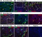 CD166 (ALCAM) Antibody in Immunohistochemistry (IHC)