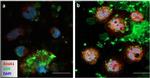 Mouse IgG (H+L) Highly Cross-Adsorbed Secondary Antibody in Immunocytochemistry (ICC/IF)