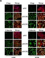 Mouse IgG (H+L) Cross-Adsorbed Secondary Antibody in Immunocytochemistry (ICC/IF)