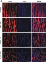 Rabbit IgG (H+L) Cross-Adsorbed Secondary Antibody in Immunohistochemistry (IHC)