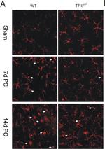 Rabbit IgG (H+L) Cross-Adsorbed Secondary Antibody in Immunohistochemistry (IHC)