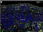 Rabbit IgG (H+L) Highly Cross-Adsorbed Secondary Antibody in Immunohistochemistry (IHC)