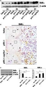 ROR gamma (t) Antibody in Western Blot, Immunohistochemistry, Immunohistochemistry (Frozen) (WB, IHC, IHC (F))