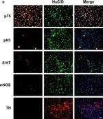 Rabbit IgG (H+L) Highly Cross-Adsorbed Secondary Antibody in Immunocytochemistry (ICC/IF)