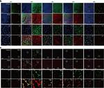 Mouse IgG (H+L) Highly Cross-Adsorbed Secondary Antibody in Immunohistochemistry (IHC)