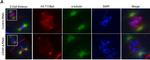 Rabbit IgG (H+L) Highly Cross-Adsorbed Secondary Antibody in Immunocytochemistry (ICC/IF)