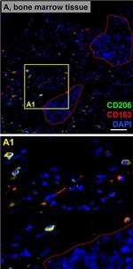 Rabbit IgG (H+L) Highly Cross-Adsorbed Secondary Antibody in Immunohistochemistry (Paraffin) (IHC (P))