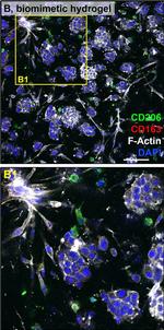 Rabbit IgG (H+L) Highly Cross-Adsorbed Secondary Antibody in Immunohistochemistry (Paraffin) (IHC (P))