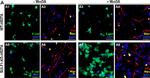 Rabbit IgG (H+L) Highly Cross-Adsorbed Secondary Antibody in Immunohistochemistry (Paraffin) (IHC (P))