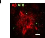 Rabbit IgG (H+L) Highly Cross-Adsorbed Secondary Antibody in Immunohistochemistry (Frozen) (IHC (F))