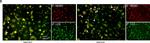 Mouse IgG (H+L) Highly Cross-Adsorbed Secondary Antibody in Immunocytochemistry (ICC/IF)