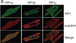 Mouse IgG (H+L) Highly Cross-Adsorbed Secondary Antibody in Immunocytochemistry (ICC/IF)