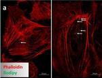 Mouse IgG (H+L) Highly Cross-Adsorbed Secondary Antibody in Immunocytochemistry (ICC/IF)