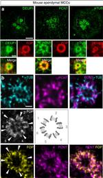 Rabbit IgG (H+L) Cross-Adsorbed Secondary Antibody in Immunocytochemistry (ICC/IF)