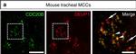 Rabbit IgG (H+L) Cross-Adsorbed Secondary Antibody in Immunocytochemistry (ICC/IF)