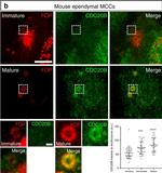 Mouse IgG2a Cross-Adsorbed Secondary Antibody in Immunocytochemistry (ICC/IF)