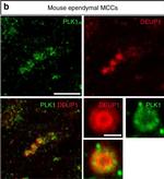 Rabbit IgG (H+L) Cross-Adsorbed Secondary Antibody in Immunocytochemistry (ICC/IF)