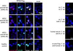 Human IgG (H+L) Cross-Adsorbed Secondary Antibody in Immunocytochemistry (ICC/IF)