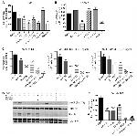 Phospho-AKT1 (Ser473) Antibody in Western Blot (WB)