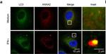 Mouse IgG (H+L) Highly Cross-Adsorbed Secondary Antibody in Immunocytochemistry (ICC/IF)