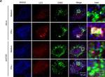 Rabbit IgG (H+L) Highly Cross-Adsorbed Secondary Antibody in Immunocytochemistry (ICC/IF)