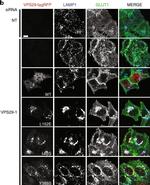 Rabbit IgG (H+L) Highly Cross-Adsorbed Secondary Antibody in Immunocytochemistry (ICC/IF)