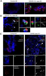 Rabbit IgG (H+L) Highly Cross-Adsorbed Secondary Antibody in Immunocytochemistry (ICC/IF)