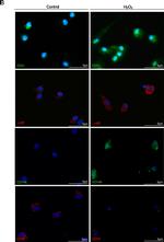 Rabbit IgG (H+L) Highly Cross-Adsorbed Secondary Antibody in Immunocytochemistry (ICC/IF)