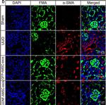 Rabbit IgG (H+L) Highly Cross-Adsorbed Secondary Antibody in Immunohistochemistry (Frozen) (IHC (F))