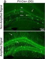 Chicken IgY (H+L) Secondary Antibody in Immunohistochemistry (IHC)