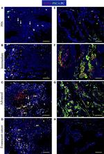 Goat IgG (H+L) Cross-Adsorbed Secondary Antibody in Immunocytochemistry (ICC/IF)