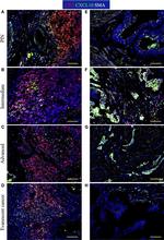 Goat IgG (H+L) Cross-Adsorbed Secondary Antibody in Immunocytochemistry (ICC/IF)