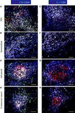 Goat IgG (H+L) Cross-Adsorbed Secondary Antibody in Immunocytochemistry (ICC/IF)