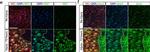 Goat IgG (H+L) Cross-Adsorbed Secondary Antibody in Immunocytochemistry (ICC/IF)