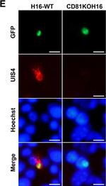 Goat IgG (H+L) Cross-Adsorbed Secondary Antibody in Immunocytochemistry (ICC/IF)