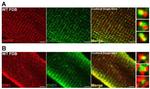 CaV1.1 Antibody in Immunohistochemistry (IHC)