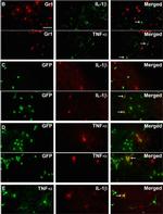 Rabbit IgG (H+L) Cross-Adsorbed Secondary Antibody in Immunohistochemistry (Frozen) (IHC (F))