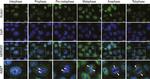 Rabbit IgG (H+L) Cross-Adsorbed Secondary Antibody in Immunocytochemistry (ICC/IF)