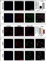 Rabbit IgG (H+L) Cross-Adsorbed Secondary Antibody in Immunocytochemistry (ICC/IF)