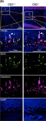 Rabbit IgG (H+L) Cross-Adsorbed Secondary Antibody in Immunohistochemistry (IHC)