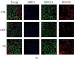 Mouse IgG1 Cross-Adsorbed Secondary Antibody in Immunohistochemistry (IHC)