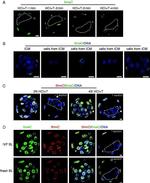 Rabbit IgG (H+L) Highly Cross-Adsorbed Secondary Antibody in Immunohistochemistry (IHC)