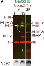 Rabbit IgG (H+L) Cross-Adsorbed Secondary Antibody in Western Blot (WB)